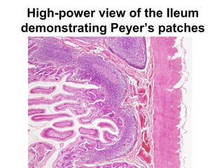 High-power view of the Ileum
demonstrating Peyer’s patches

 