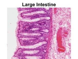Large Intestine

 