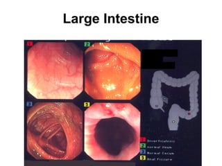 Large Intestine

 