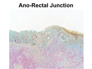 Ano-Rectal Junction

 
