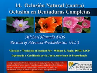 14. Oclusiόn Natural (contra)
Oclusiόn en Dentaduras Completas

Michael Hamada DDS
Division of Advanced Prosthodontics, UCLA
*Editado y Traducido al Español Por: William J. Pagán, DMD, FACP
Diplomado y Certificado por la Junta Americana de Prostodoncia
This program of instruction is protected by copyright ©. No portion of this
program of instruction may be reproduced, recorded or transferred by any
means electronic, digital, photographic, mechanical etc., or by any
information storage or retrieval system, without prior permission.

 