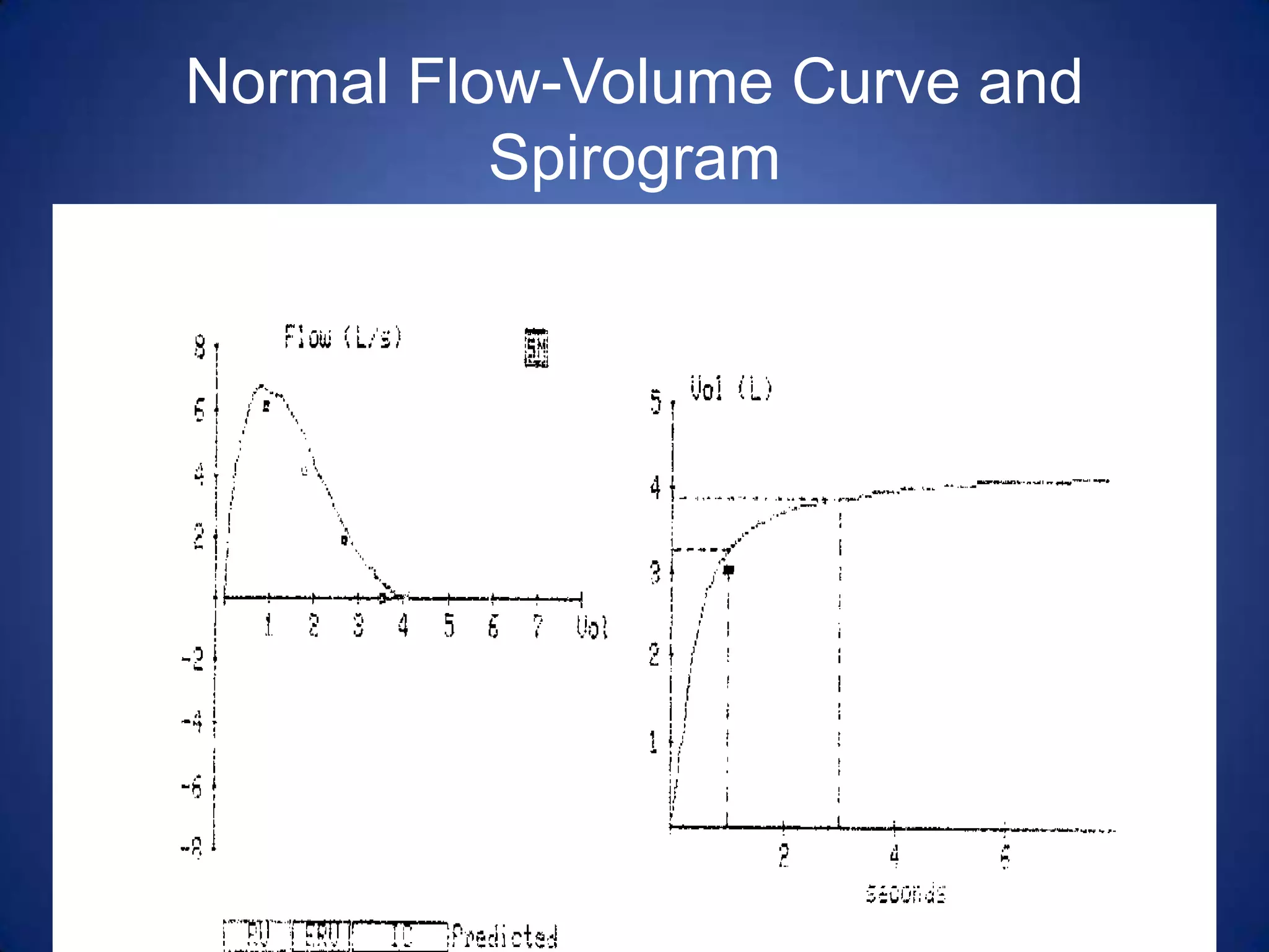 Normal Flow-Volume Curve and
Spirogram
www.anaesthesia.co.in
 
