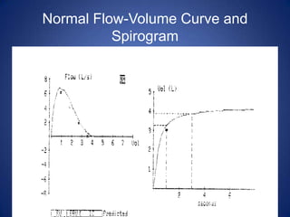 Normal Flow-Volume Curve and
Spirogram
www.anaesthesia.co.in
 