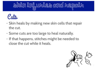 skin injuries and repair
• Skin heals by making new skin cells that repair
the cut.
• Some cuts are too large to heal naturally.
• If that happens, stitches might be needed to
close the cut while it heals.
Cuts
 
