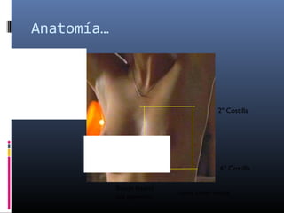 Anatomía…
Borde lateral
del esternón
Línea axilar media
2º Costilla
6º Costilla
Irrigación:
•Arteria torácica interna.
•Arteria torácica lateral y
toracoacromial.
•Arterias intercostales
posteriores,
Drenaje venoso:
•Vena Axilar,
•Vena torácica interna.
 