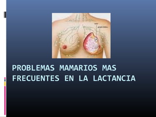 PROBLEMAS MAMARIOS MAS
FRECUENTES EN LA LACTANCIA
 