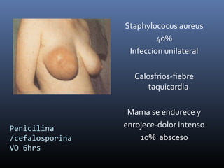 Penicilina
/cefalosporina
VO 6hrs
Staphylococus aureus
40%
Infeccion unilateral
Calosfrios-fiebre
taquicardia
Mama se endurece y
enrojece-dolor intenso
10% absceso
 