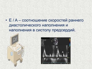 • E / A – соотношение скоростей раннего 
диастолического наполнения и 
наполнения в систолу предсердий. 
 
