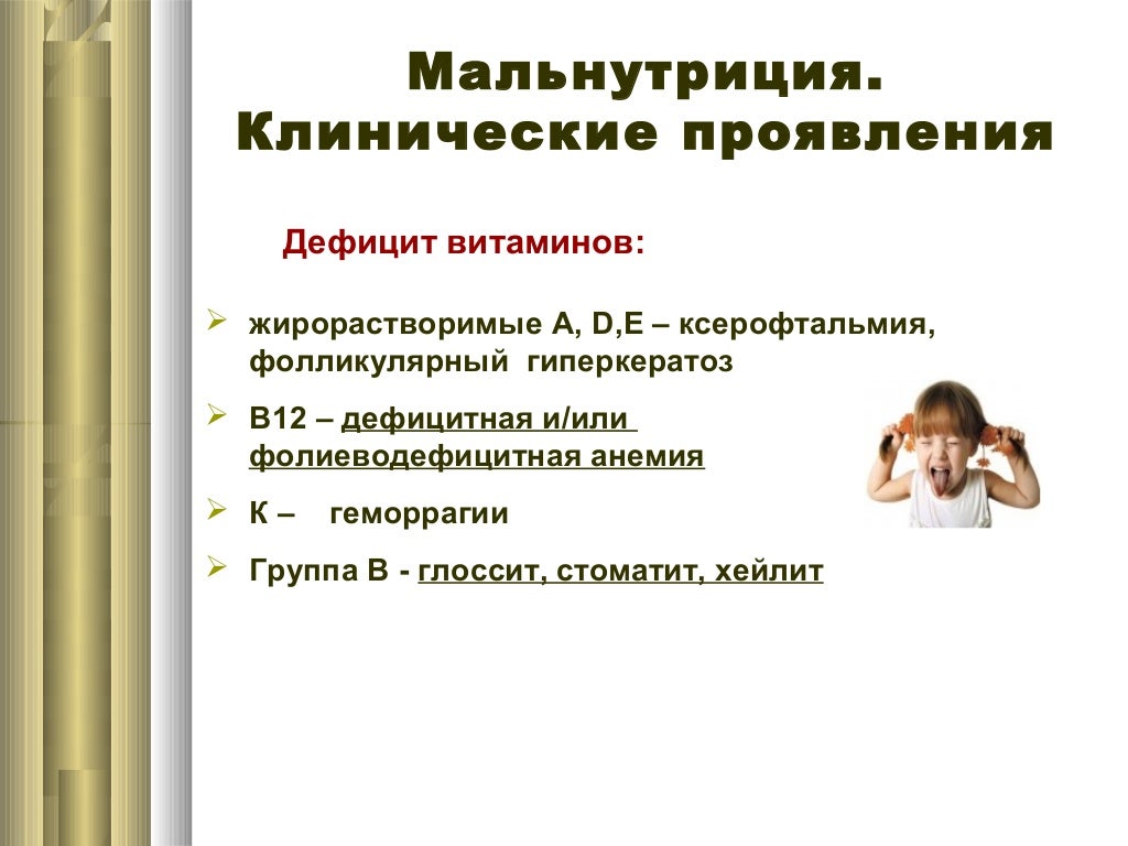 Предикторы синдрома мальнутриции. Интенсивность заболевания это. Синдром мальнутриции у пожилых презентация. Мальнутриция у пожилых. Мальнутриция это.