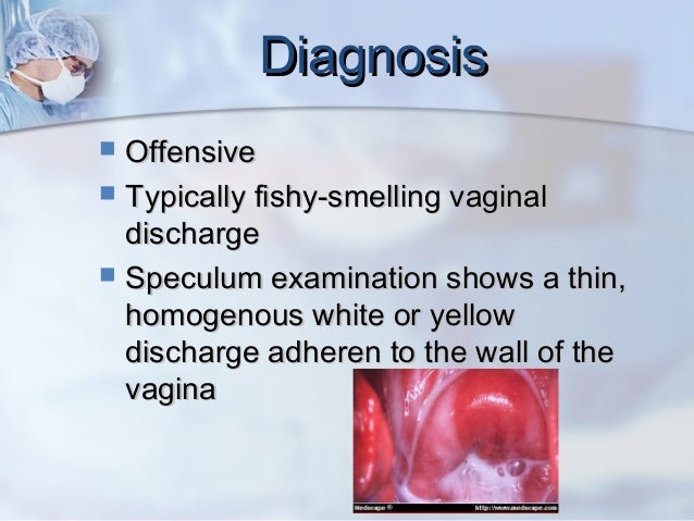 14. bakterial vaginosis