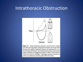 Intrathoracic Obstruction
 