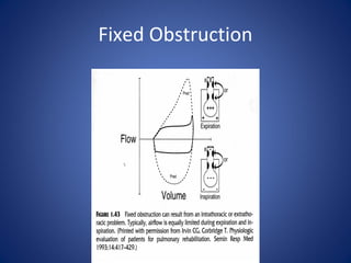 Fixed Obstruction
 