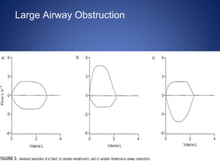 Large Airway Obstruction
 