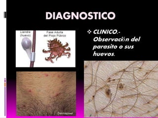 CLINICO.-
Observación del
parasito o sus
huevos.
 