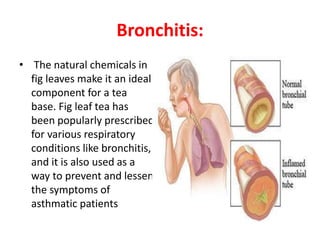 14.health benefits of fig By A;;ah Dad Khan | PPT