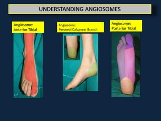 manzi how much does the angiosome concept really matter? | PPTX