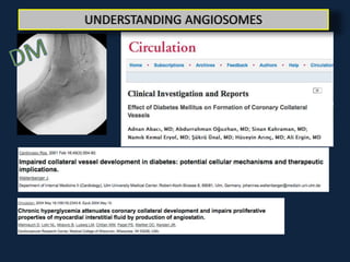 manzi how much does the angiosome concept really matter? | PPTX