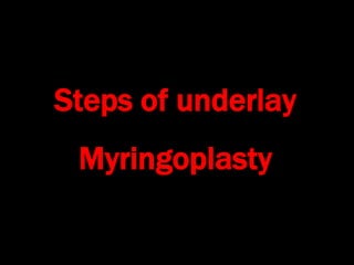 Steps of underlay
Myringoplasty
 