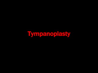 Tympanoplasty
 