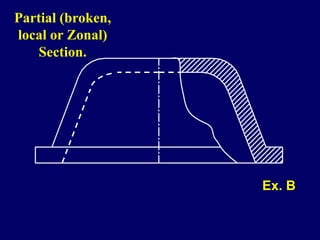 Partial (broken,
local or Zonal)
Section.
Ex. B
 