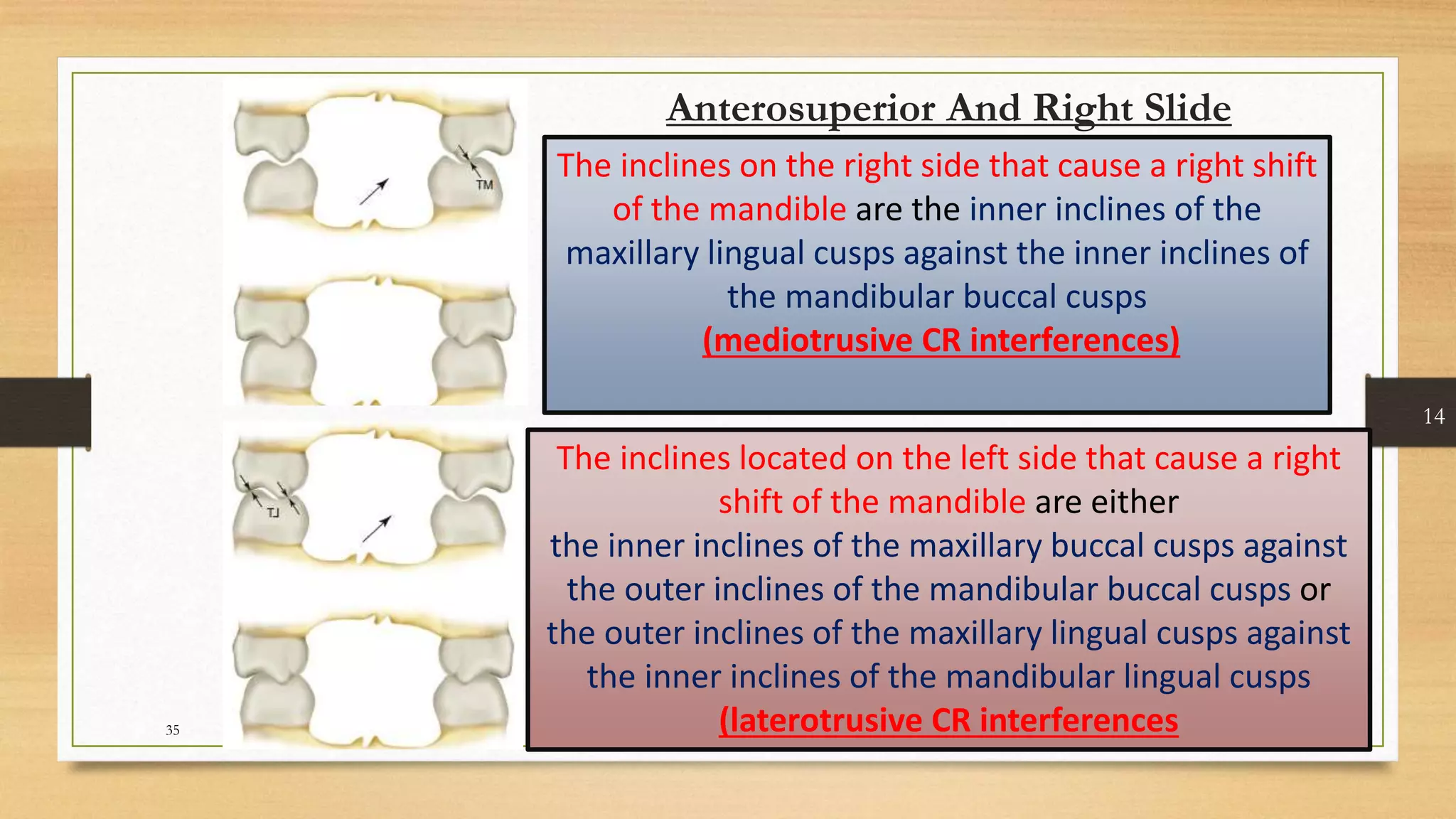Occlusal equilibration Kelly PPT
