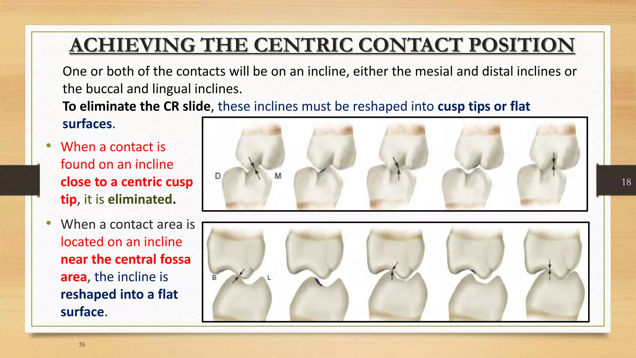 Occlusal equilibration Kelly PPT