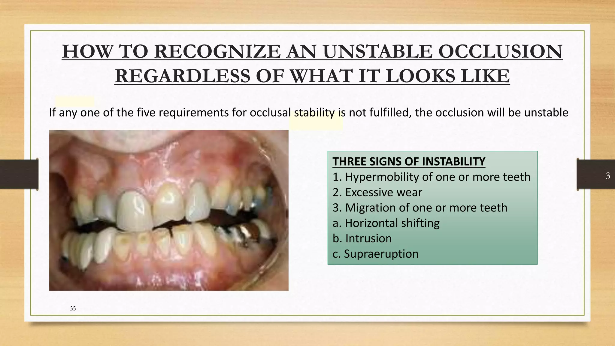 Occlusal equilibration Kelly PPT