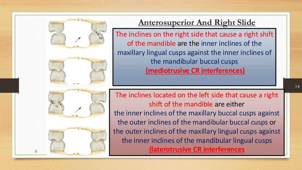 Occlusal equilibration Kelly