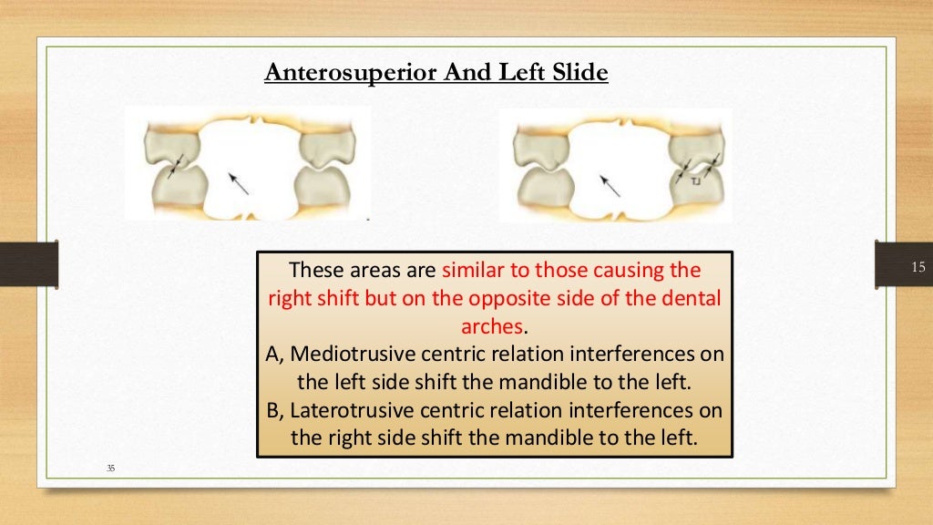 Occlusal equilibration Kelly