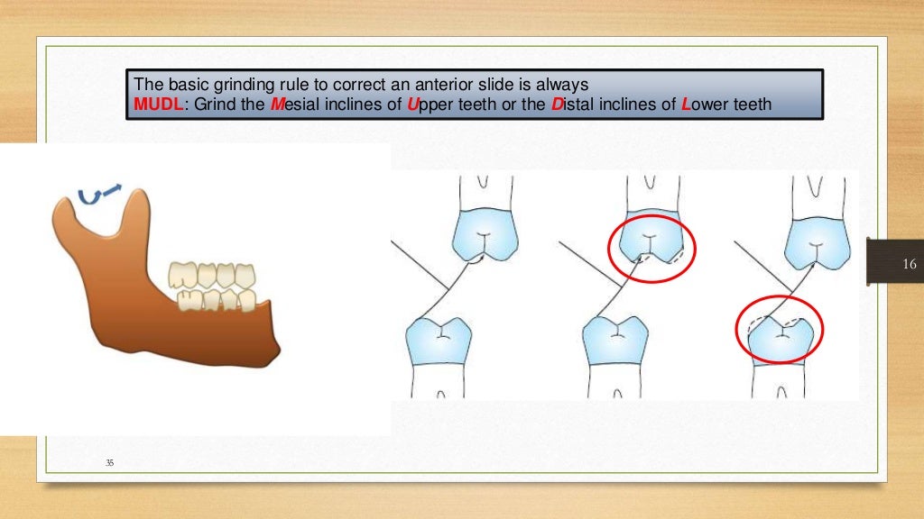 Occlusal equilibration Kelly