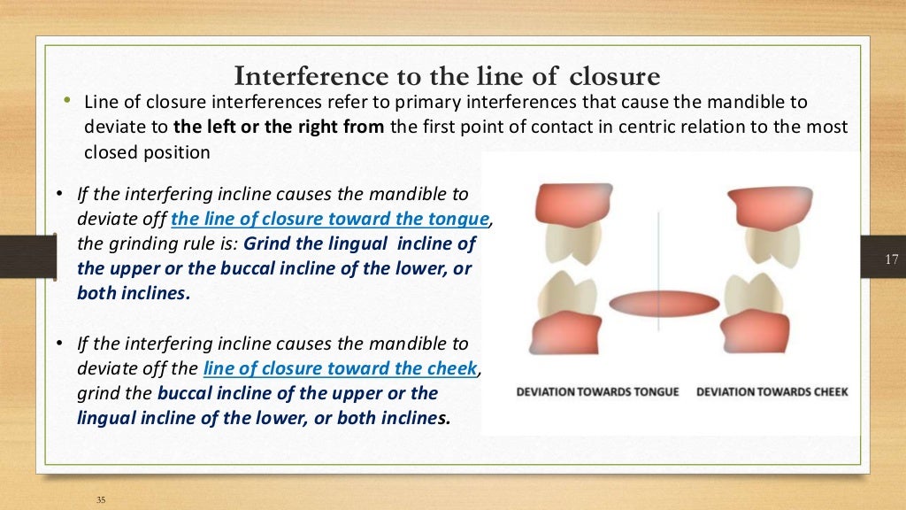 Occlusal equilibration Kelly