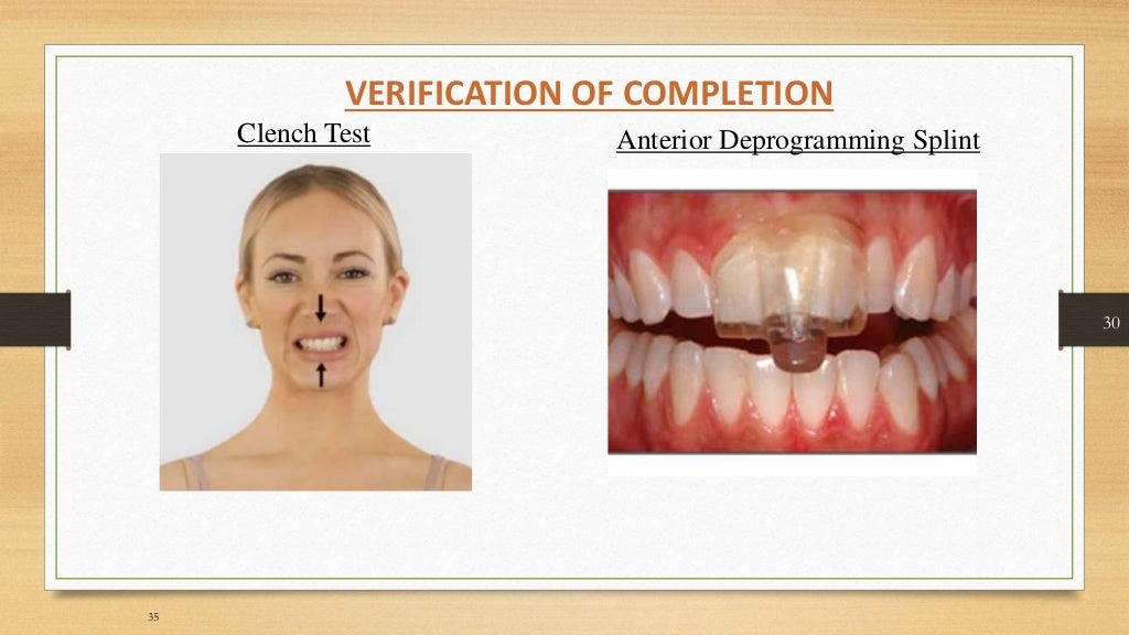 Occlusal equilibration Kelly