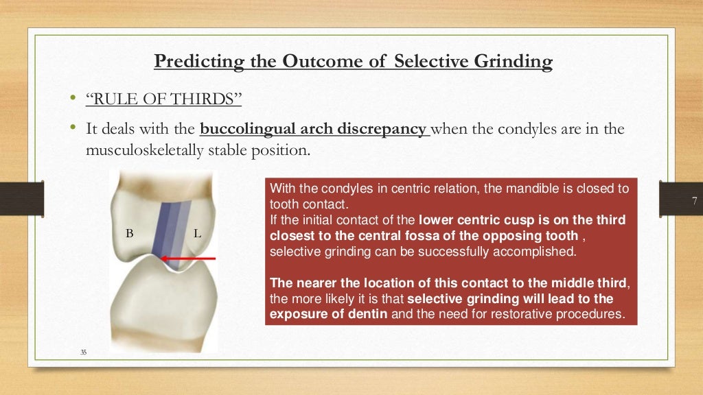 Occlusal equilibration Kelly