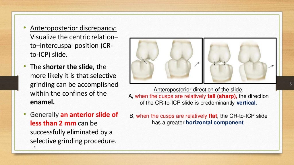 Occlusal equilibration Kelly