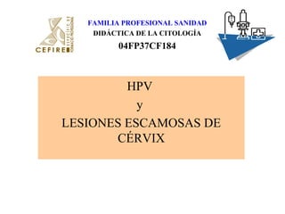 HPV
y
LESIONES ESCAMOSAS DE
CÉRVIX
FAMILIA PROFESIONAL SANIDAD
DIDÁCTICA DE LA CITOLOGÍA
04FP37CF184
 