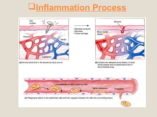 Inflammation Process
 