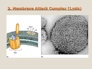 2. Membrane Attack Complex (Lysis)2. Membrane Attack Complex (Lysis)
 