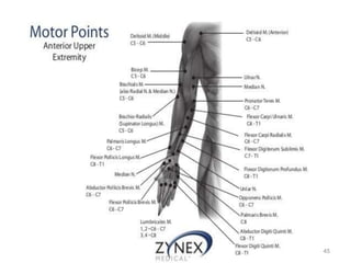 motor point | PPTX