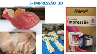 5- IMPRESSÃO 3D
 