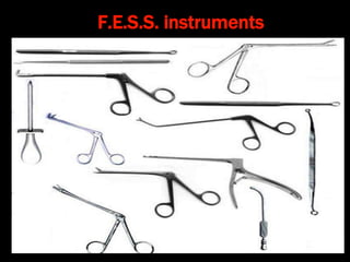F.E.S.S. instruments
 
