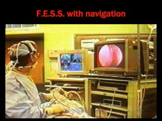 F.E.S.S. with navigation
 