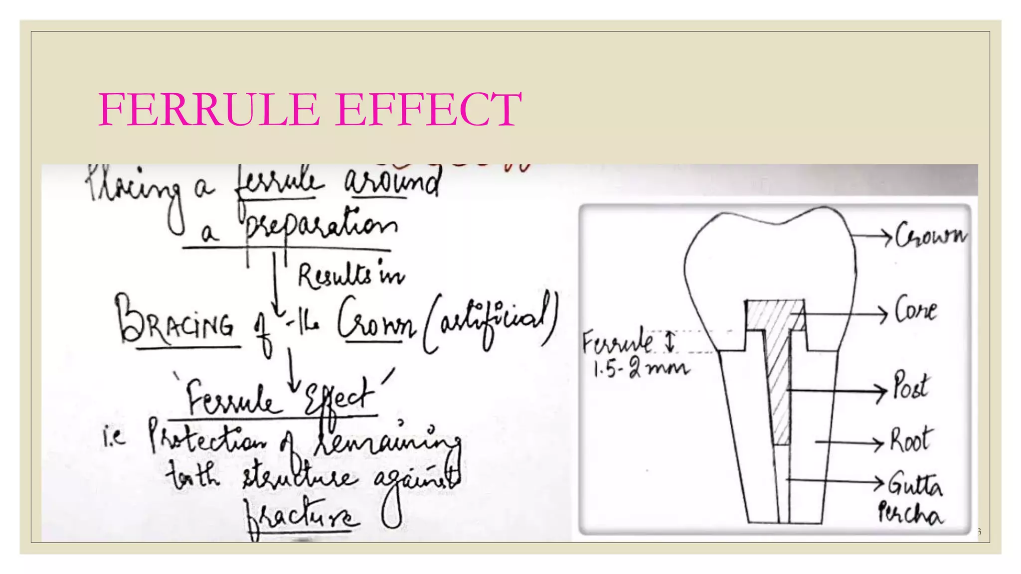 Ferrule Effect PPSX