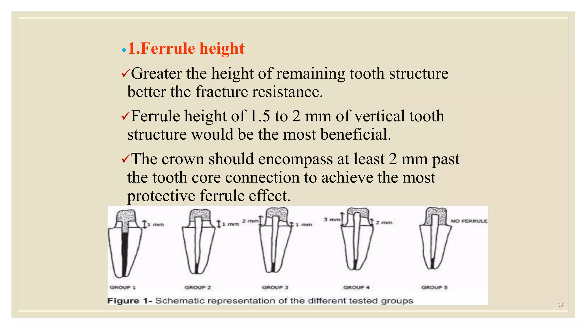 •1.Ferrule height
Greater the height of remaining tooth structure
better the fracture resistance.
Ferrule height of 1.5 to 2 mm of vertical tooth
structure would be the most beneficial.
The crown should encompass at least 2 mm past
the tooth core connection to achieve the most
protective ferrule effect.
19
 
