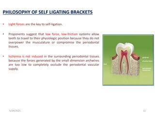 PHILOSOPHY OF SELF LIGATING BRACKETS
• Light forces are the key to self-ligation.
• Proponents suggest that low force, low-friction systems allow
teeth to travel to their physiologic position because they do not
overpower the musculature or compromise the periodontal
tissues.
• Ischemia is not induced in the surrounding periodontal tissues
because the forces generated by the small dimension archwires
are too low to completely occlude the periodontal vascular
supply.
5/24/2021 11
 