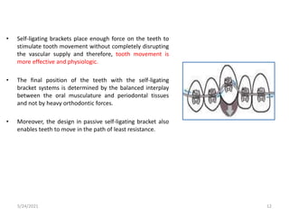 • Self-ligating brackets place enough force on the teeth to
stimulate tooth movement without completely disrupting
the vascular supply and therefore, tooth movement is
more effective and physiologic.
• The final position of the teeth with the self-ligating
bracket systems is determined by the balanced interplay
between the oral musculature and periodontal tissues
and not by heavy orthodontic forces.
• Moreover, the design in passive self-ligating bracket also
enables teeth to move in the path of least resistance.
5/24/2021 12
 