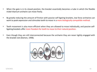 • When the gate is in its closed position, the bracket essentially becomes a tube in which the flexible
nickel-titanium archwire can move freely.
• By greatly reducing the amount of friction with passive self-ligating brackets, low force archwires can
work to peak expression and stimulate teeth to move in a more biologically compatible method.
• Teeth movement is also more efficient when they are allowed to move individually, and passive self-
ligating brackets offer more freedom for teeth to move to their natural position.
• Even though they are still interconnected because the archwire they are never tightly engaged with
the bracket slot (Damon, 1998).
5/24/2021 13
 