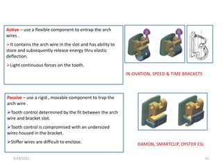 Passive – use a rigid , movable component to trap the
arch wire .
Tooth control determined by the fit between the arch
wire and bracket slot.
Tooth control is compromised with an undersized
wires housed in the bracket.
Stiffer wires are difficult to enclose.
IN-OVATION, SPEED & TIME BRACKETS
Active – use a flexible component to entrap the arch
wires .
It contains the arch wire in the slot and has ability to
store and subsequently release energy thru elastic
deflection.
Light continuous forces on the tooth.
DAMON, SMARTCLIP, OYSTER ESL
5/24/2021 15
 