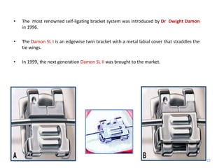 • The most renowned self-ligating bracket system was introduced by Dr Dwight Damon
in 1996.
• The Damon SL I is an edgewise twin bracket with a metal labial cover that straddles the
tie wings.
• In 1999, the next generation Damon SL II was brought to the market.
5/24/2021 22
 