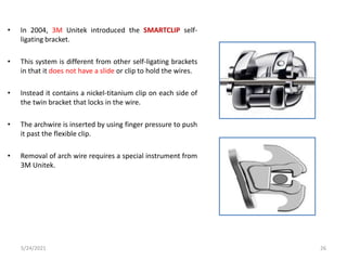 • In 2004, 3M Unitek introduced the SMARTCLIP self-
ligating bracket.
• This system is different from other self-ligating brackets
in that it does not have a slide or clip to hold the wires.
• Instead it contains a nickel-titanium clip on each side of
the twin bracket that locks in the wire.
• The archwire is inserted by using finger pressure to push
it past the flexible clip.
• Removal of arch wire requires a special instrument from
3M Unitek.
5/24/2021 26
 