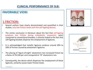 CLINICAL PERFORMANCE OF SLB:
FAVORABLE VIEW:
1.FRICTION:
• Several authors have clearly demonstrated and quantified in their
studies, very low friction levels with the self-ligating devices.
• The similar conclusion in literature about the fact that self-ligating
produces less friction during orthodontic movement, when
compared to conventional brackets, is directly linked to the fact that
self-ligating brackets dispense the employment of ligatures.
• It is acknowledged that metallic ligatures produce around 30% to
50% of friction caused by elastomeric ligatures.
• The placing of ‘figure-of-eight’ elastomeric ties increased friction by
a factor of 70-220 per cent compared to “O” elastomeric ties.
• Consequently, the device which dispenses the employment of these
ligatures, certainly causes lower friction levels.
5/24/2021 27
 